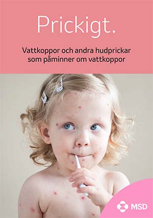 Bild för Prickboken - Föräldrarinformation vattkoppor och andra hudprickar